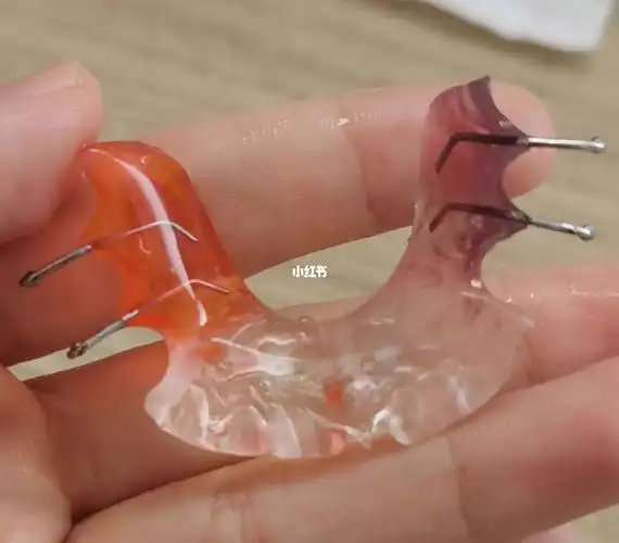 戴上说话大舌头,吃饭几乎囫囵吞枣,下前牙酸疼,真的栓q,哭了#矫正牙齿