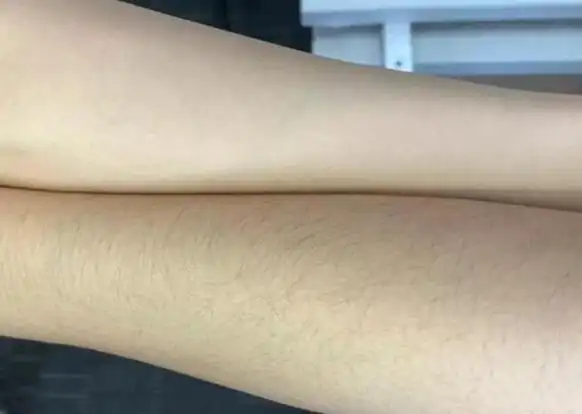 有的女性朋友体毛旺盛,有的却"光秃秃"?谁的体质更好些?