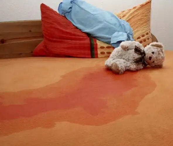 世界遗尿日儿童尿床可持续到成年专家呼吁尽早治疗