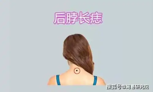 原创身体5颗"房产"痣,一个比一个值钱,代代发家,辈辈富!