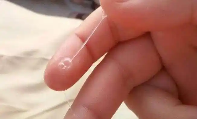 期之后,那么卵巢就开始进行排卵,女性也就会发现自己内裤上的白带变得