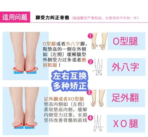 xo型腿矫正小腿外翻足外翻脚偏矫正器八字脚跟骨鞋子外侧磨损纠正 e14