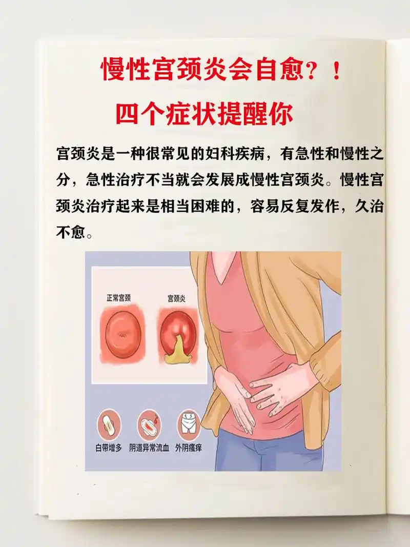 慢性宫颈炎会自愈?