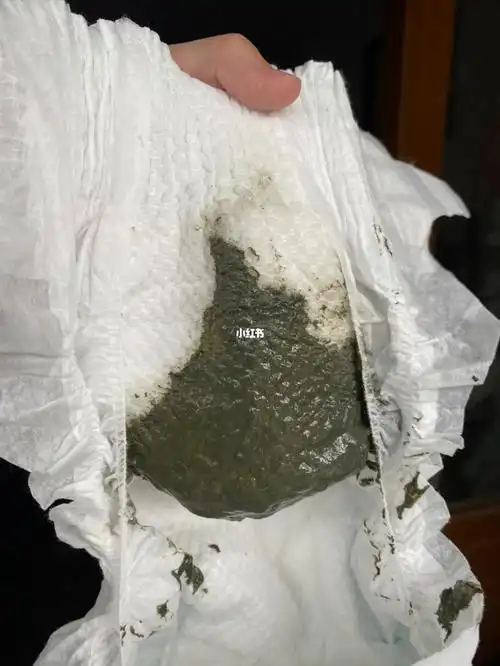 粑粑的状态,但是脸上的疹子依旧在那,之前喝母乳疹子就退了将近一个月