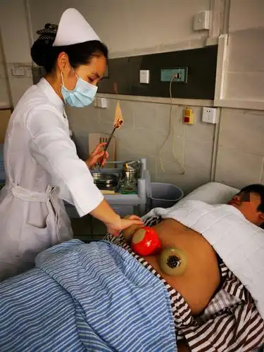 拔罐减肥疗法(副本)