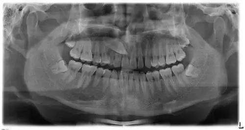 本来只是做个检查 现在可怎么办?