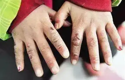 寒冷的冬天玩手机,我有一"套" 再也不担心细嫩的小手受伤了