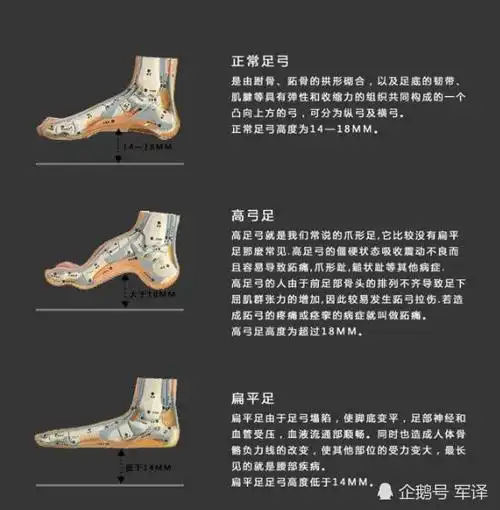 扁平足的人,日常生活可能不会有太大的影响和感受,但如果面对部队每天