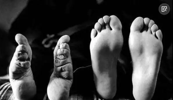 盘点世界十大最恐怖习俗中国三寸金莲脚变畸形太残忍