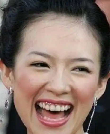 笑得比哭还难看的6位女星,还是闭嘴微笑好一点