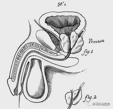 男性丁丁从青春到年老的几个状态,男性生理认知必修课,女生勿进|睾丸