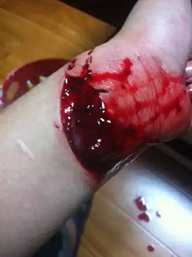 自残的图片有没有 最好是真实的 像一点 我朋友向我要