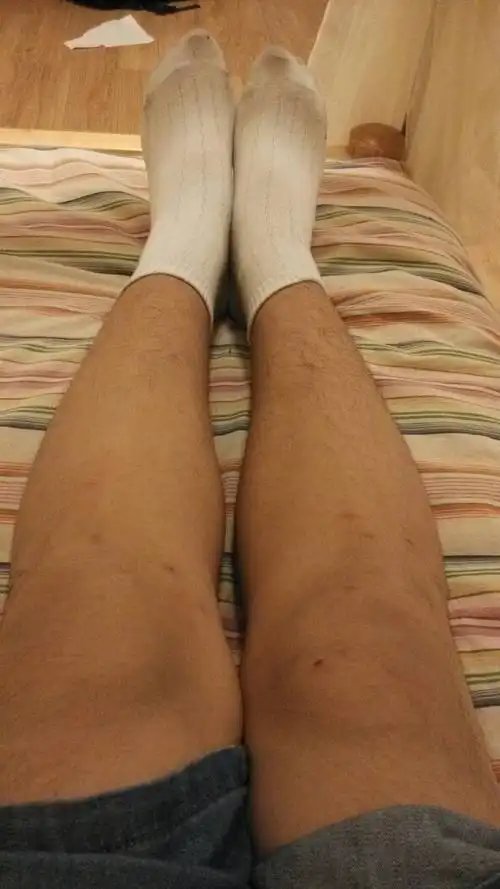 近期准备减肥,突然发现自己的小腿向外弯曲,如何矫正?(成功的进来)