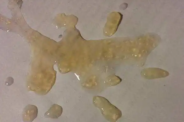 精子果冻状怎么办 5个方法让你重拾健康