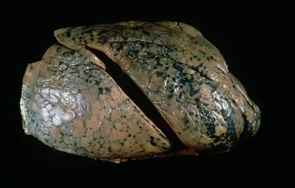 达到这个限度,再大的烟瘾也要抑制|戒烟|尼古丁|吸烟|戒掉_网易订阅