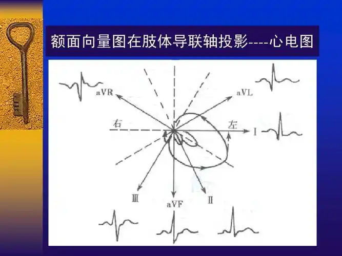 额面向量图在肢体导联轴投影----心电图