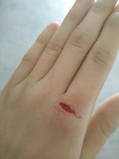 今天早上不小心把手给划到了,好大的伤口,都看见筋骨了,能擦药水么