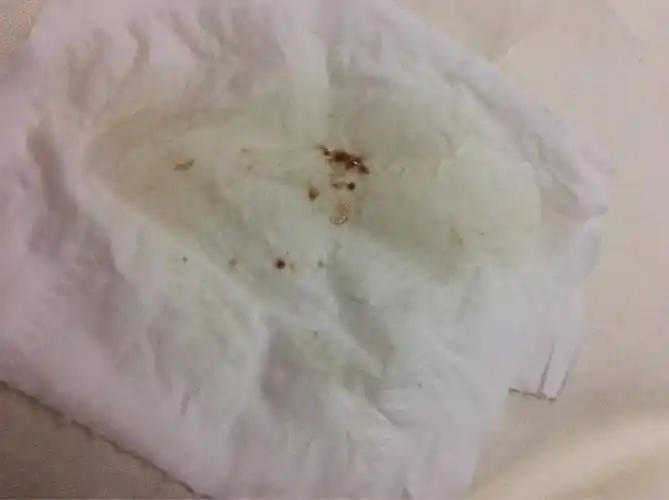 怀孕43,天怎么没有早孕反应呢?