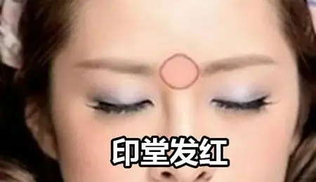 印堂发红代表会发生什么征兆吗