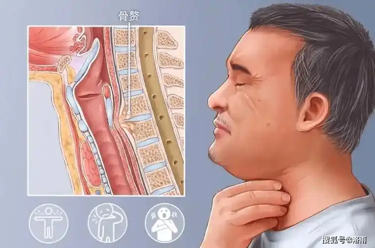 颈椎病会引起哪些不适症状_患者_脖子_感觉