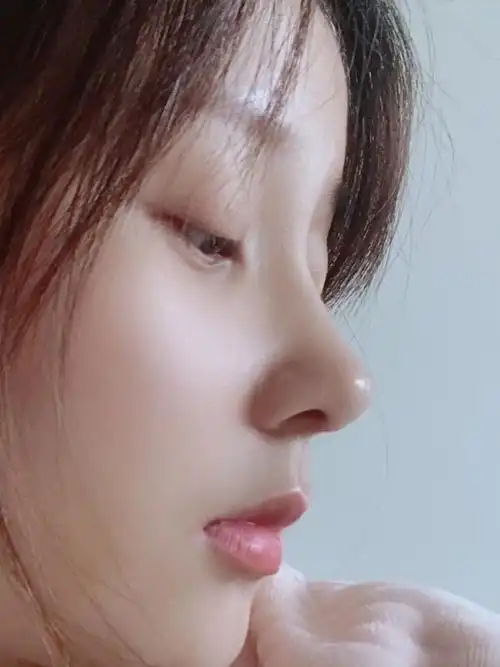 田永华91 半肋77膨体要求:直鼻微翘,山根起点低,自_圈子-新氧美容