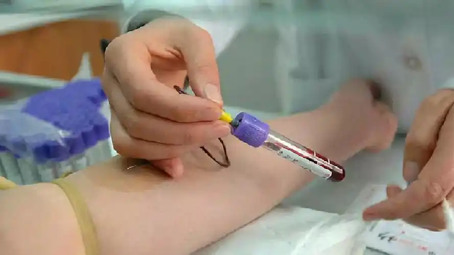 这样,就能学会"一针见血"的本领,成为抽血高手.