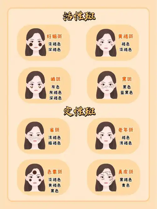斑点干货丨自测你是定性斑还是活性斑71