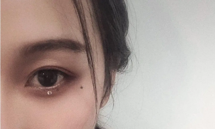 正确的泪痣的位置图 泪痣的位置与命运分析