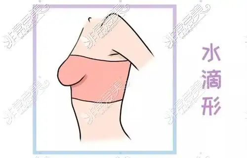 胸型水滴型和下垂型区别特点形态哪个好看都在这儿了