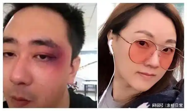 王自健惨遭老婆家暴!6次烟头烫伤,狂扇几百耳光!好在后来离婚