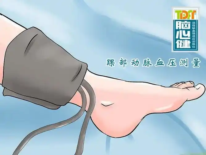 脑心健监护治疗仪为什么要测量四肢血压踝部血压怎么测量