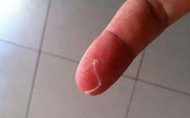 男性精液粘稠呈胶冻状是怎么回事观察了好久还是胶冻状