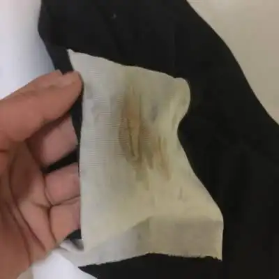 怀孕1个多月,晚上发现内裤有这种分泌物,怎麼回事?