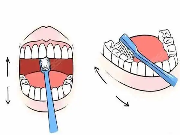 正确刷牙