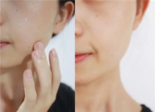 咪一喵去角质啫喱是溶液质地~无磨砂,去角质时不伤皮肤~不会容易被磨