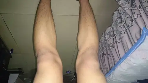 我的腿型是正常腿型吗 如果不是该如何改善