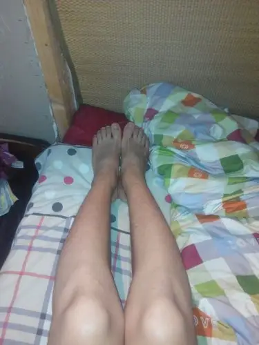 我大腿跟小腿连接的位置特别弯,整的小腿夹不上,这种情况需要怎么办