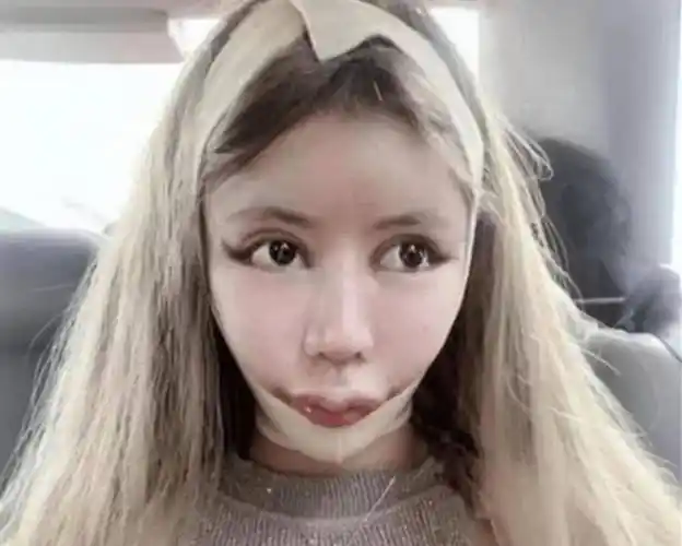 "花费近百万",三年整了60次的网红女孩现今如何:判若两人