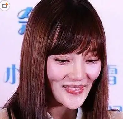 娱乐圈十大整容失败明星排行榜,萧蔷整容惨不忍睹