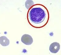 巨核细胞图册_百度百科