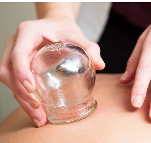 拔罐减肥方法拔罐减肥的正确方法你了解吗