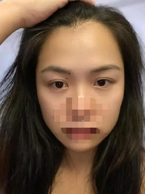 发际线高而且有个旋到底适合啥样的刘海呢