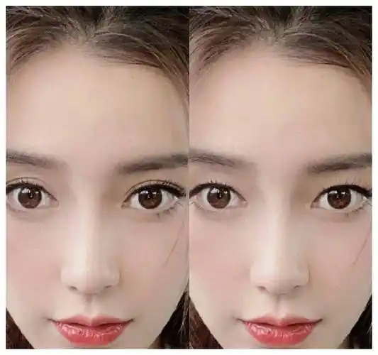 女星变身奇迹!单眼皮逐渐双眼皮,史无前例,惊艳亮相