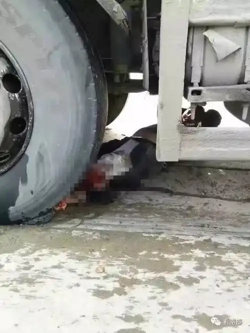 双佛镇惨烈车祸男子左腿被碾成肉泥仅皮肉相连
