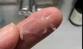 天天刷牙还是口臭的黄牙妹,竟因少了这个……_牙齿_市集_牙膏