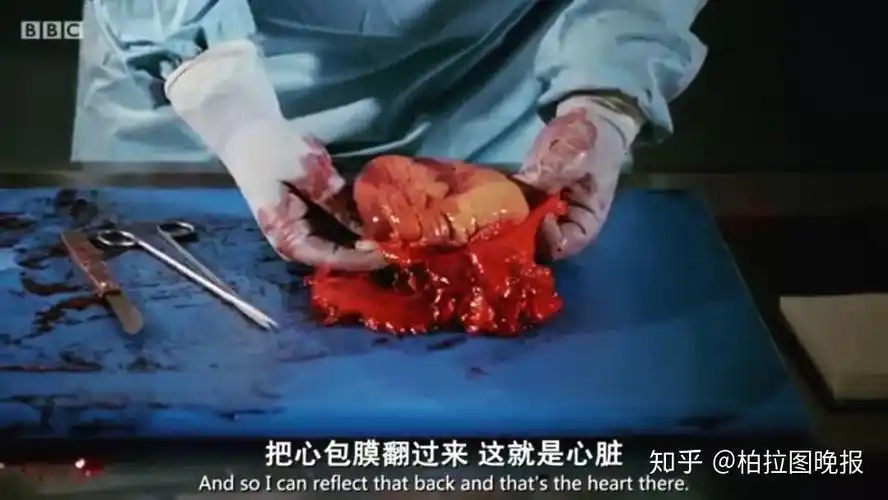 看到他们手起刀落解剖了一个胖子我真的觉得要减肥了
