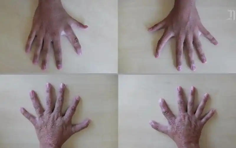 法语听力材料:六个手指头的人six doigts à chaque main _ une