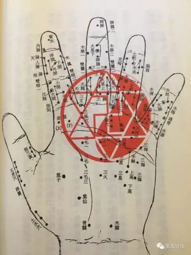 董氏针灸林正泰案例分享之骨关木关中关穴