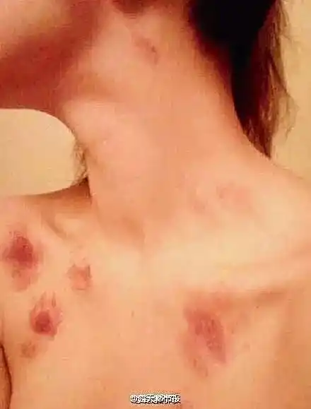 弟弟发现,从男友家回来的姐姐脖子上全是吻痕,结果