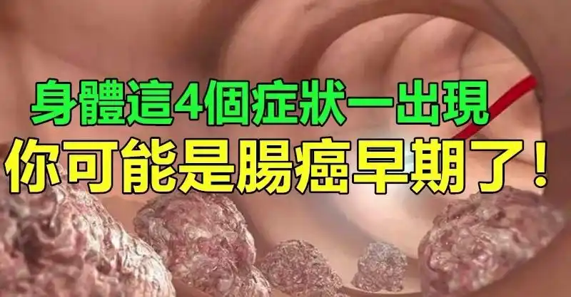 身体这4个症状一出现,你可能是「肠癌」早期了,3分钟就有一人因「大